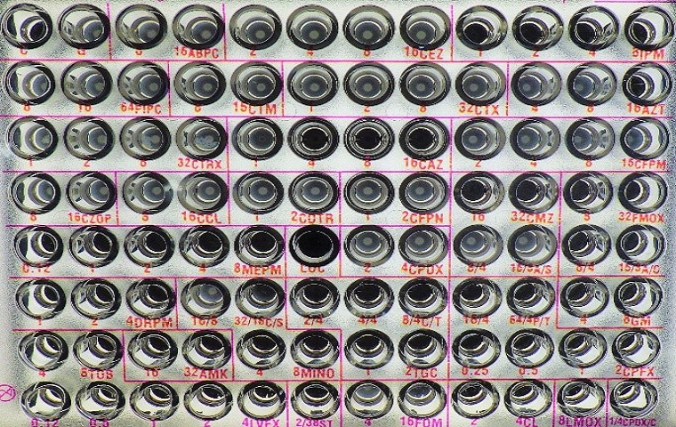 薬剤感受性試験