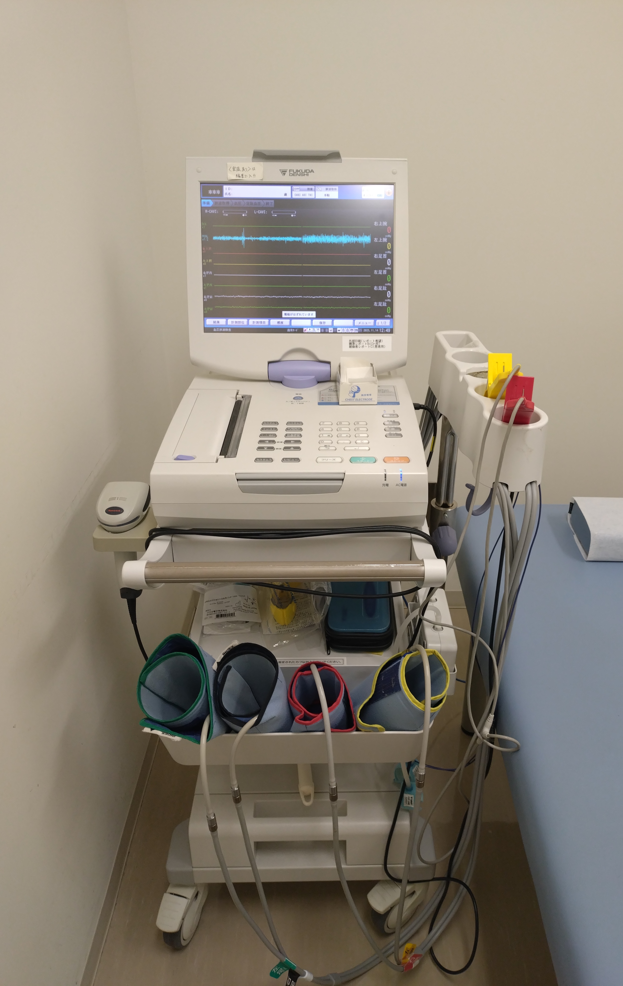 CAVI・ABI・TBI検査