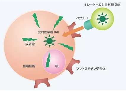ルタテラ治療